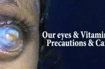 Our eyes and Vitamin A - Precautions & Care