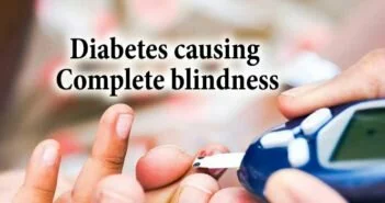 Diabetes causing complete blindness