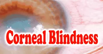 Corneal Blindness