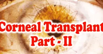 Corneal Transplant - Part - II
