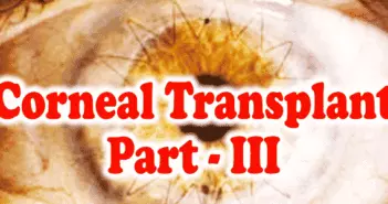 Corneal Transplant - Part - III
