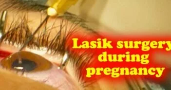 Lasik surgery during pregnancy