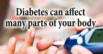 Diabetes can affect many parts of your body